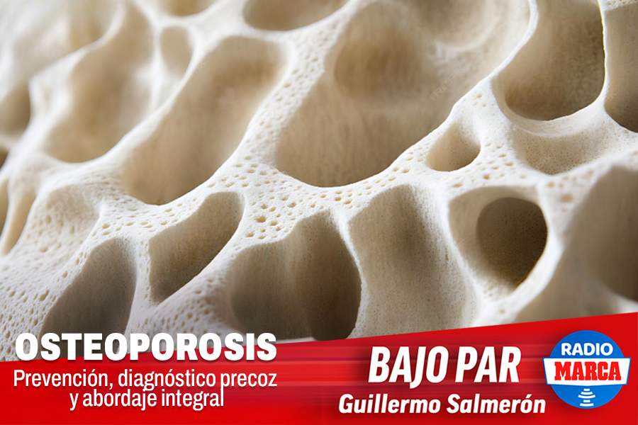 25.12.03 Bajo Par Osteoporosis